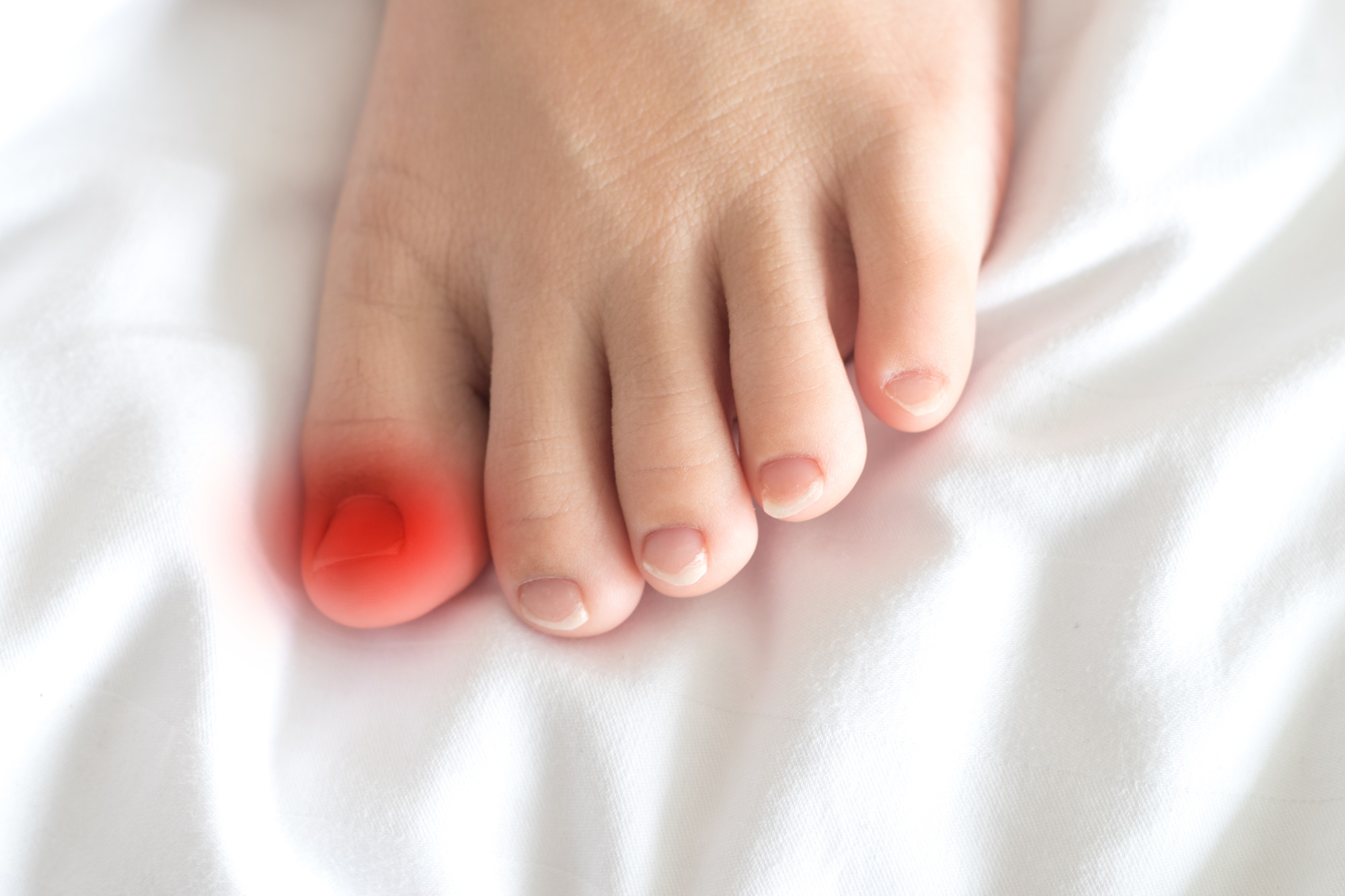 Read more about the article What Are the Best Shoes for Ingrown Toenails?